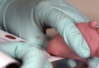 Dövlət tibb müəssisələrində aparılan neonatal skrininq müayinələr nəticəsində heç bir körpədə xəstəlik aşkarlanmayıb