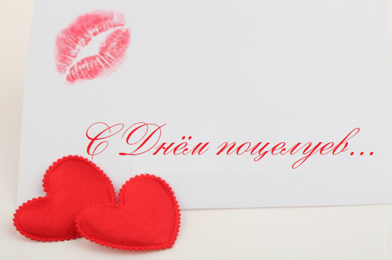 Всемирный день поцелуя в жизни азербайджанских звезд (ФОТО/ВИДЕО)
