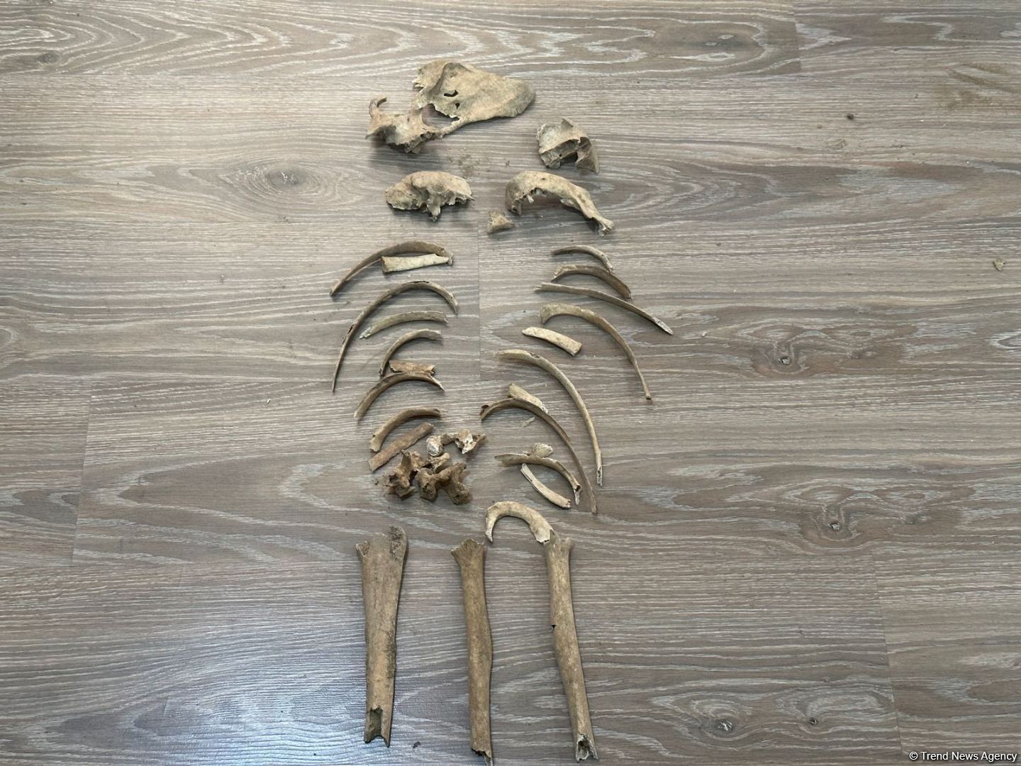 Распространены кадры человеческих останков, обнаруженных в Агдаме (ФОТО)