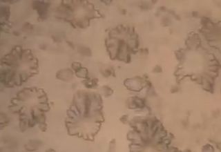 Zəmzəm suyunu mikroskopla araşdırdılar - Ortaya çıxan görüntü təəccübləndirdi (VİDEO)