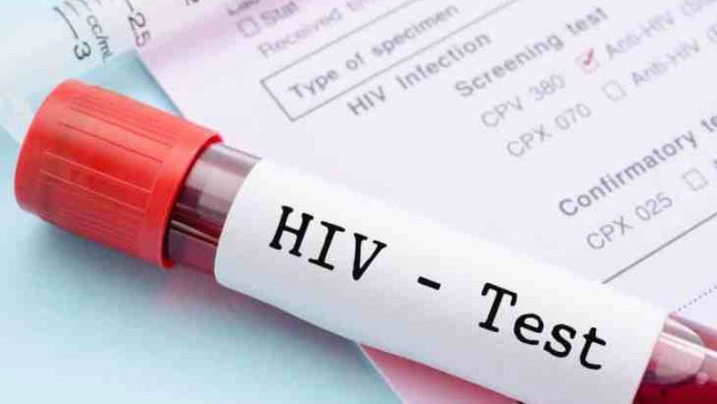В Азербайджане в 2 раза сократилось число инфицированных ВИЧ - завотделом Центра борьбы со СПИДом