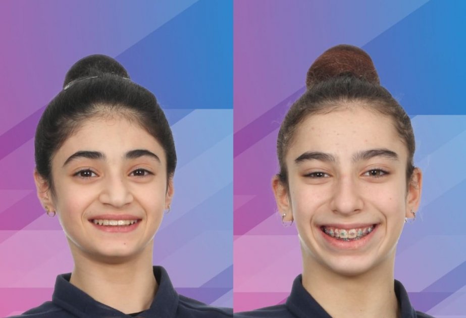 Азербайджанские гимнастки завоевали медали на международном турнире в Германии (ФОТО)